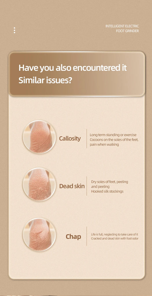 Electric Dusting Grinding Foot Remover Peeling Pedicure Home Grinding Foot Leather Power Display Charging Minor Cocoon Removal