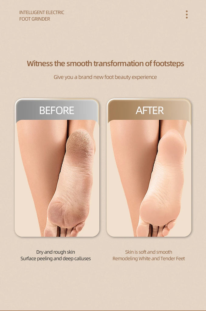 Electric Dusting Grinding Foot Remover Peeling Pedicure Home Grinding Foot Leather Power Display Charging Minor Cocoon Removal