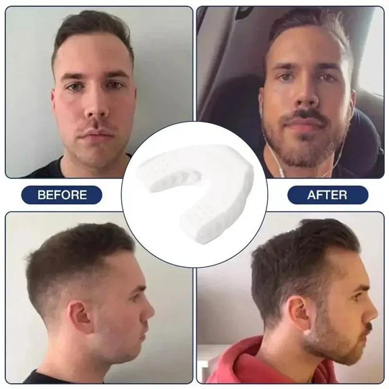 U Shape Jaw Exerciser New Facial Pop N Go Mouth Jawline Face Fitness Muscle Chew Ball Bite Breaker Training Equipment